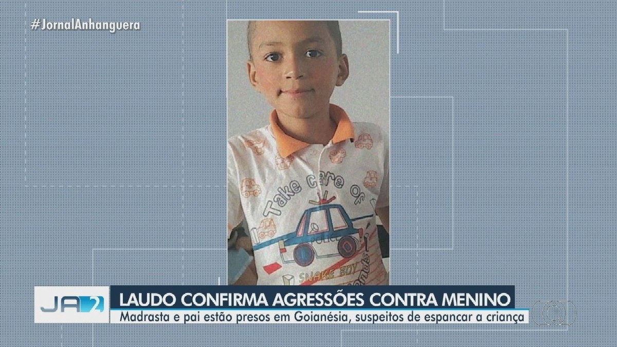 Madrasta Confessa Que Agrediu Menino Que Morreu Após Infecção Causada