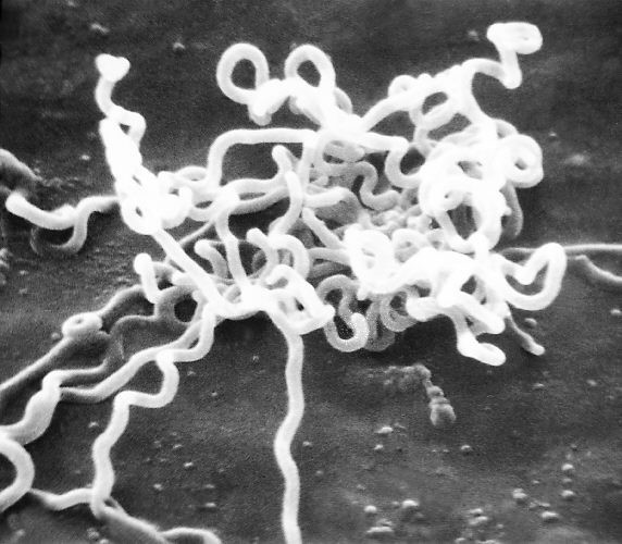 Treponema pallidum, a bactéria causadora da sífilis (Foto: Domínio público)