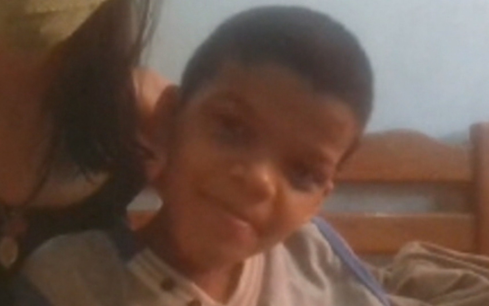 Menino de 9 anos é a primeira criança com varíola dos macacos em Goiás