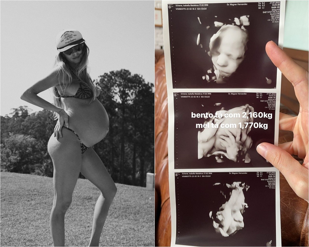 Isa Scherer compartilhou ultrassom dos filhos (Foto: Reprodução/Instagram)