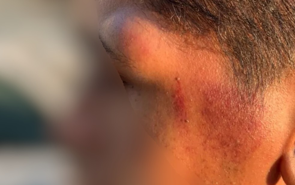 Jovem denuncia ter sido agredido por PM — Foto: Reprodução/TV Anhanguera