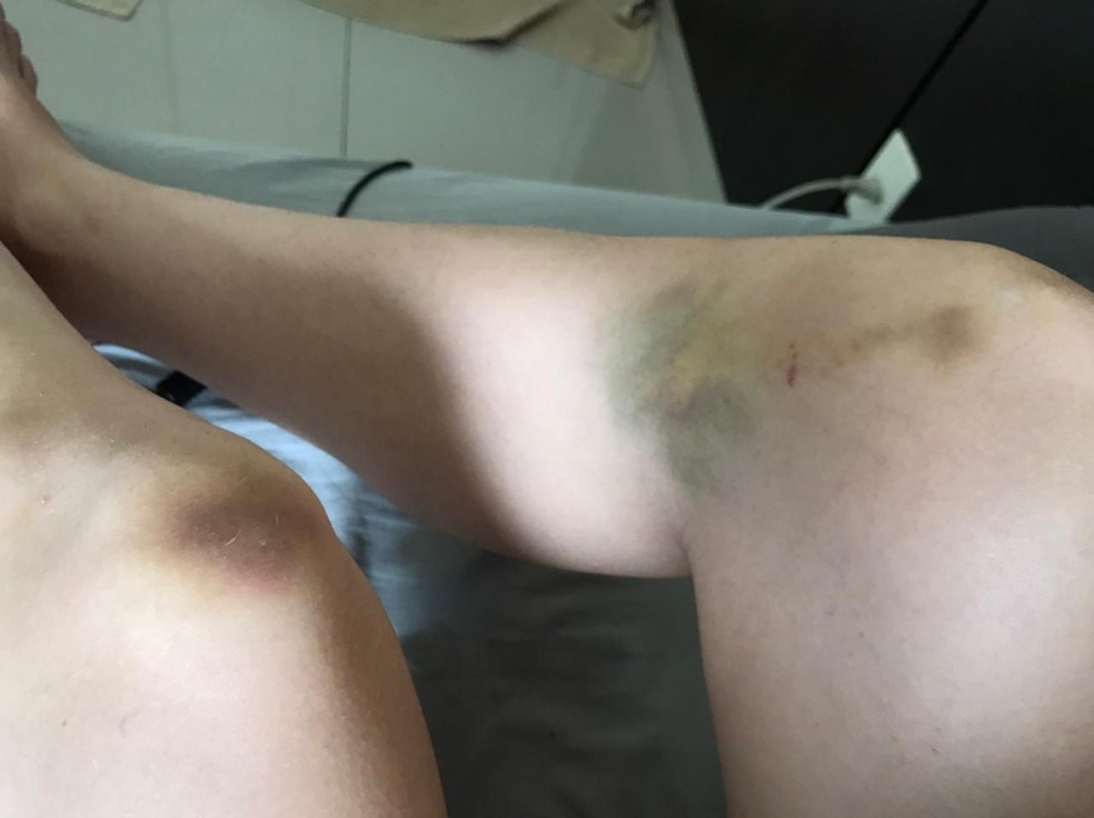 Estudante denuncia ex-namorado por agressão e ameaça de morte em Sorocaba — Foto: Arquivo pessoal