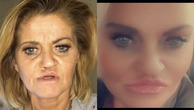 Danniella Westbrook antes e após primeira de quatro cirurgias para reconstrução do rosto (Foto: Reprodução/Instagram)
