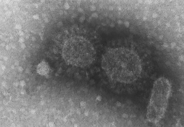 molecula, coronavirus, covid-19 (Foto: Instituto Adolfo Lutz)