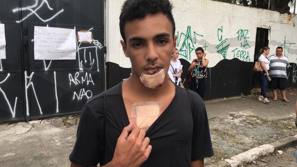 Leonardo Vinicius Santana, de 16 anos, é um dos sobreviventes do massacre na escola Raul Brasil, em Suzano.  — Foto: Natan Lira/G1