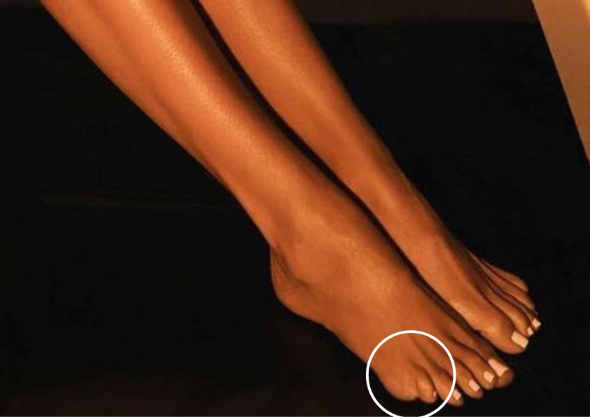 Fãs debatem nascimento de novo dedo no pé de Khloé Kardashian (Foto: Reprodução/Instagram)