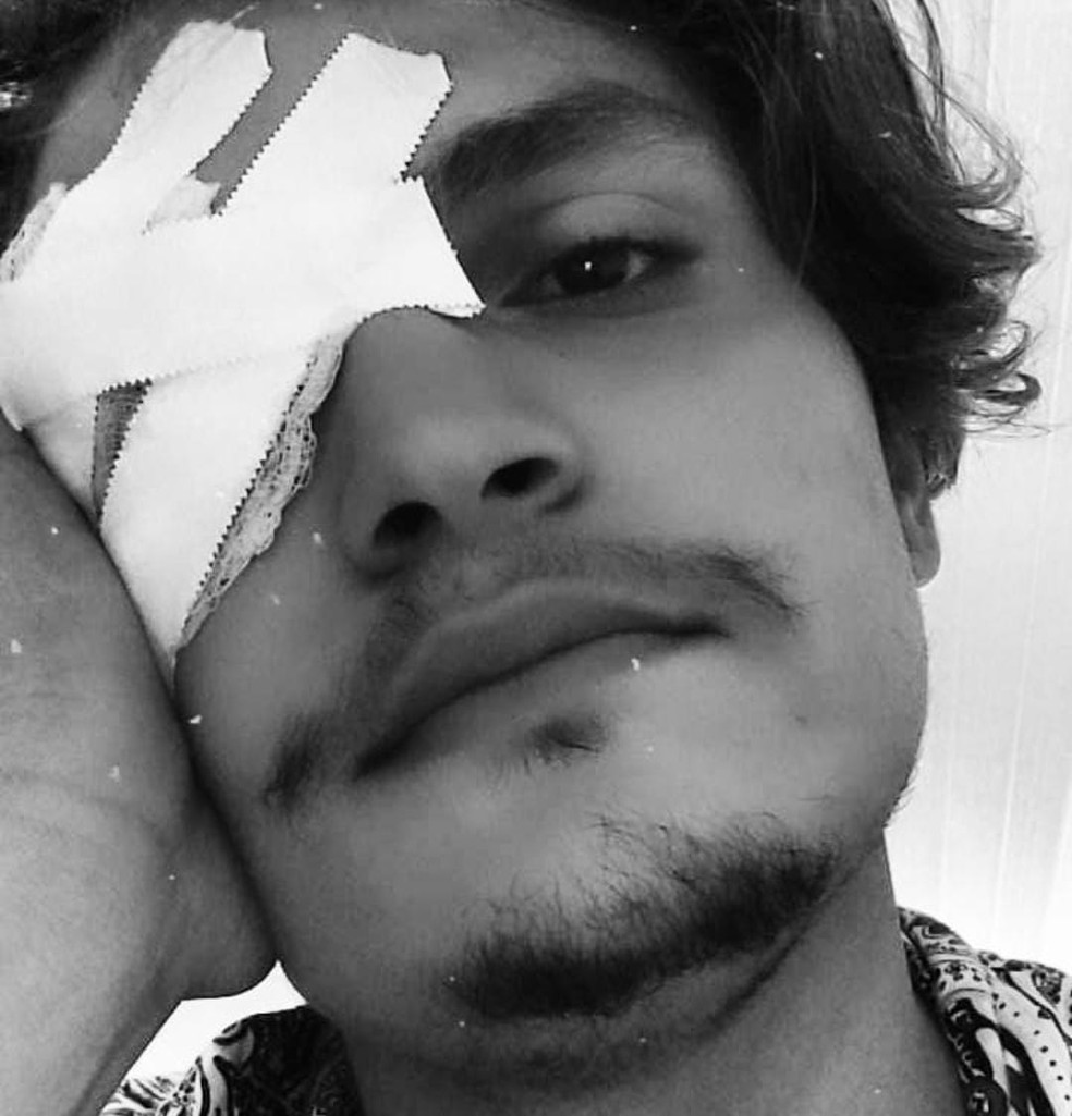 Artista de 19 anos é agredido com chave de fenda no AC e corre risco de perder a visão — Foto: Arquivo pessoal