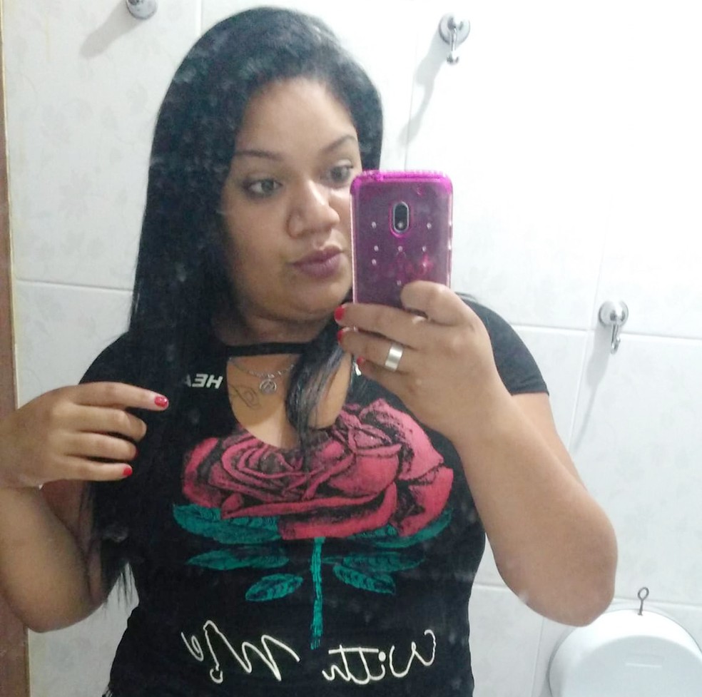 Bruna Jenifer Cirilo, 21, teve mais de 80% do corpo queimado em ItanhaÃ©m, SP (Foto: Arquivo Pessoal)