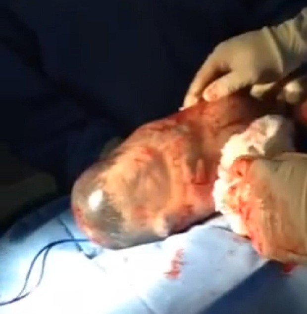 Bebê dentro do saco amniótico (Foto: Reprodução Facebook)