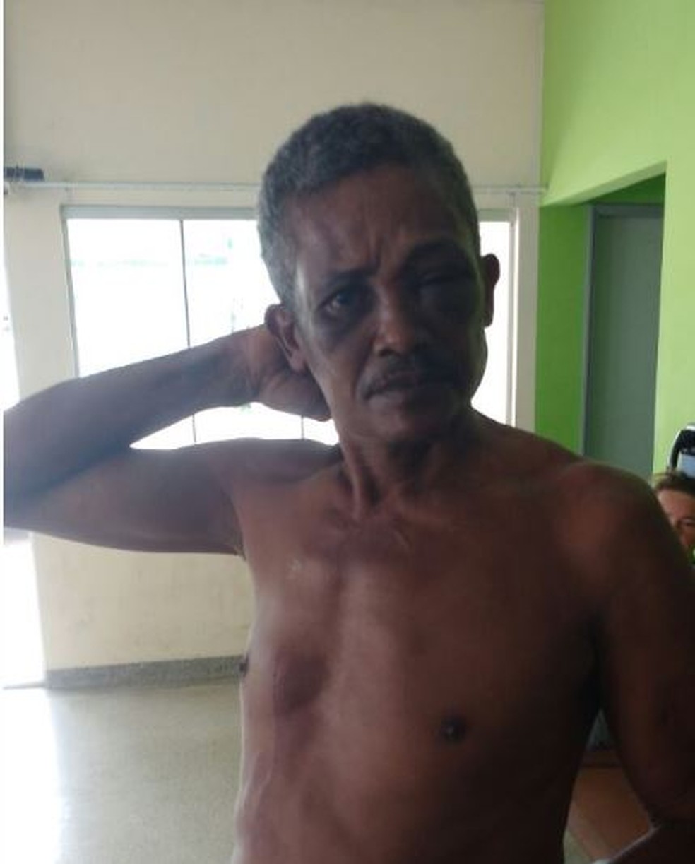 Agricultor bateu na mulher e foi espancado pelas filhas e amarrado até a polícia chegar  (Foto: Adelcimar Carvalho/G1)