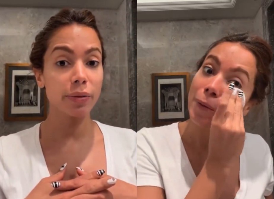 Dermatologista faz alerta sobre skincare com sangue feito por Anitta