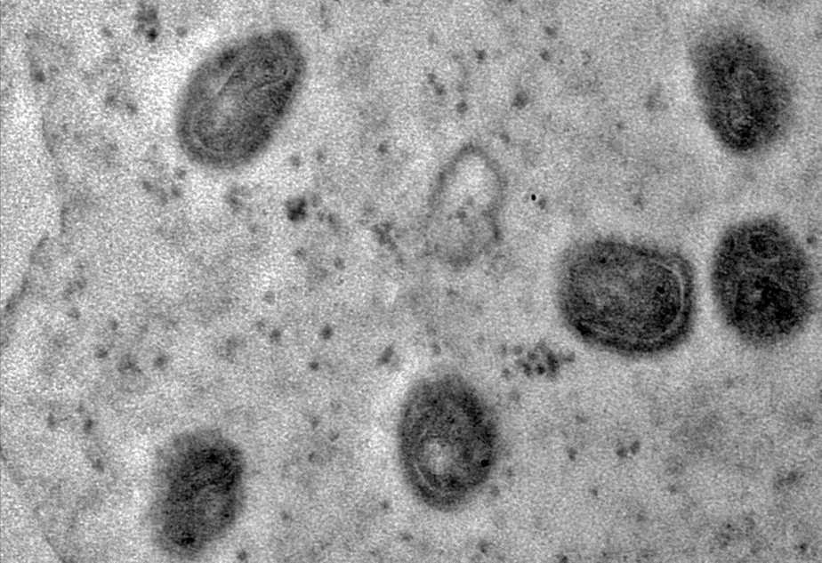 Fiocruz isola o vírus monkeypox e registra em imagens sua estrutura detalhada