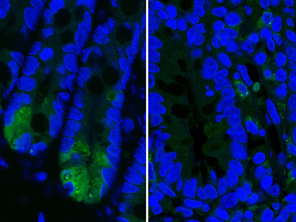 Células de intestino saudável (esq.) produzem enzima antibacteriana, diferentemente das células com doença de Chron (esq.) — Foto: M. Schaubeck/TUM