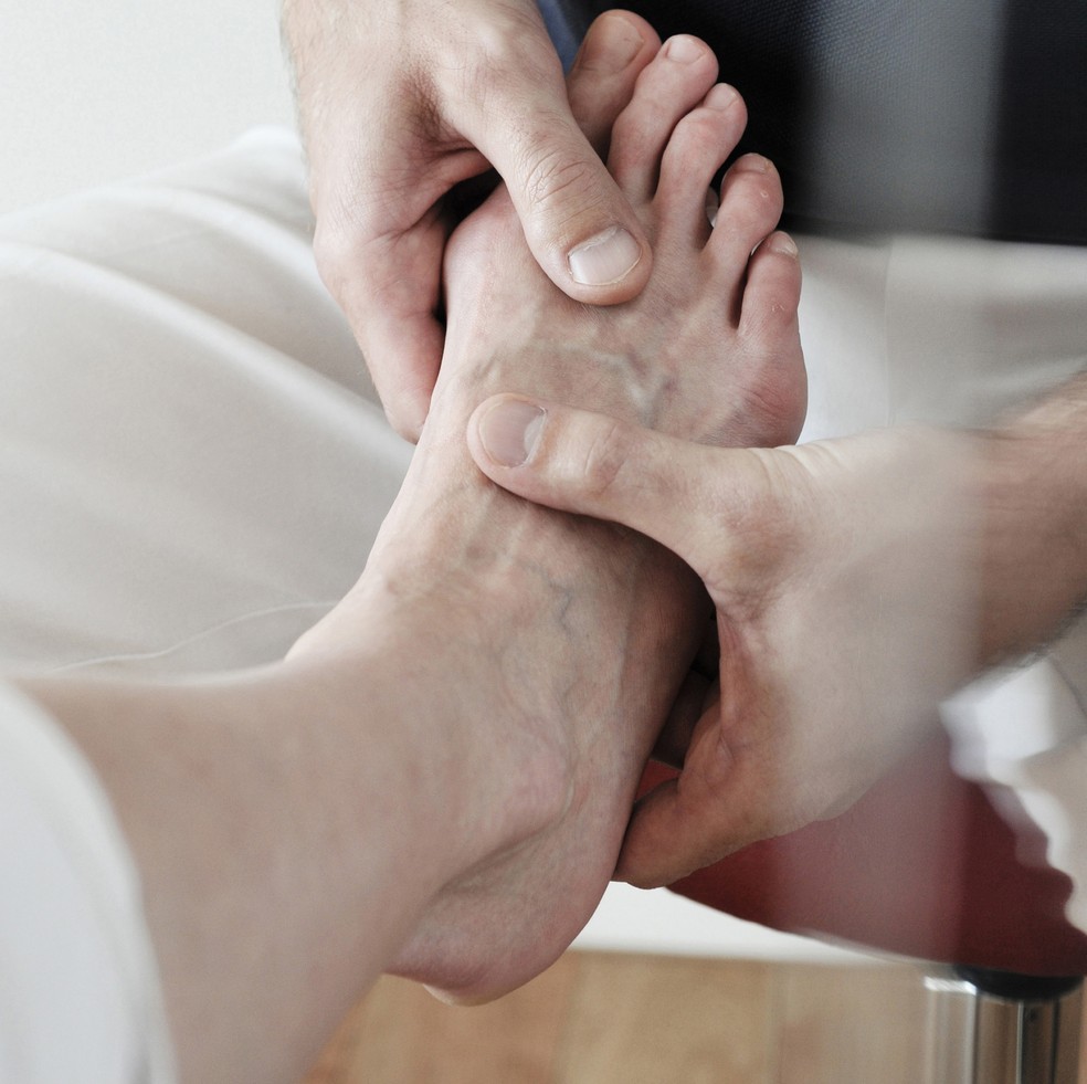 Ortopedista descreve a clinodactilia, que pode deixar dedos de pés e mãos tortos (Foto: Getty Images)