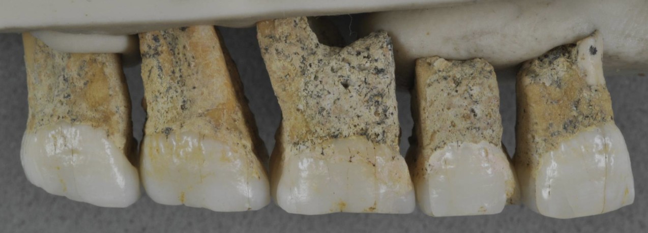Dentes encontrados na caverna de Callao, nas Filipinas (Foto: CALLAO CAVE ARCHAEOLOGY PROJECT/ Divulgação)