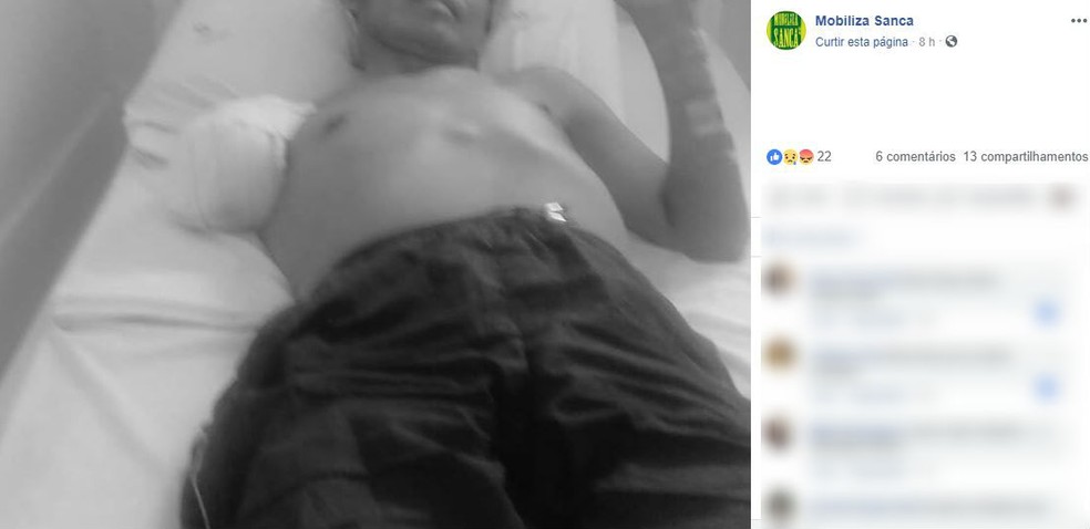Polícia Civil investiga agressão a homem indígena que teve o braço amputado em São Carlos — Foto: Reprodução/Facebook