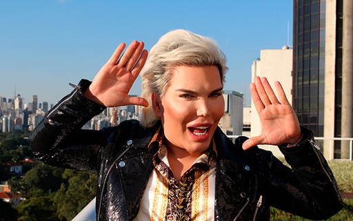 Rodrigo Alves, o Ken Humano, irá retirar gordura das costas e