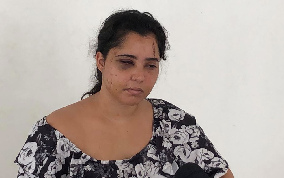 Advogada denunciou agressÃµes de ex-namorado na Bahia â Foto: Vanderson Nascimento/TV Bahia