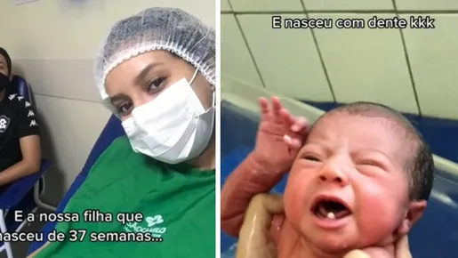 Bebê nasce com dois dentes em Belém do Pará e surpreende família e equipe médica
