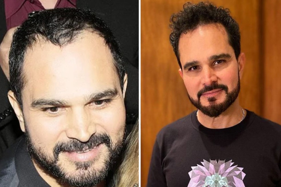 Luciano Camargo com os cabelos mais cheios após cirurgia  — Foto: Reprodução/Instagram