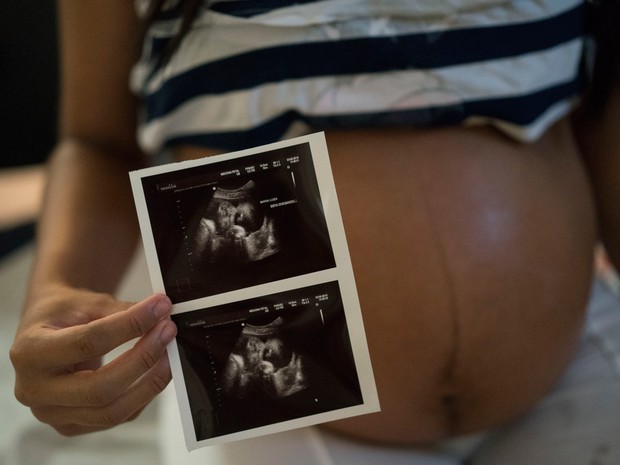 Grávida de seis meses, Isabela Cristina foi infectada pelo vírus da zika durante gestação, mas exames feitos em hospital do Recife revelaram que seu bebê não tem sinais de microcefalia  (Foto: AP Photo/Felipe Dana)