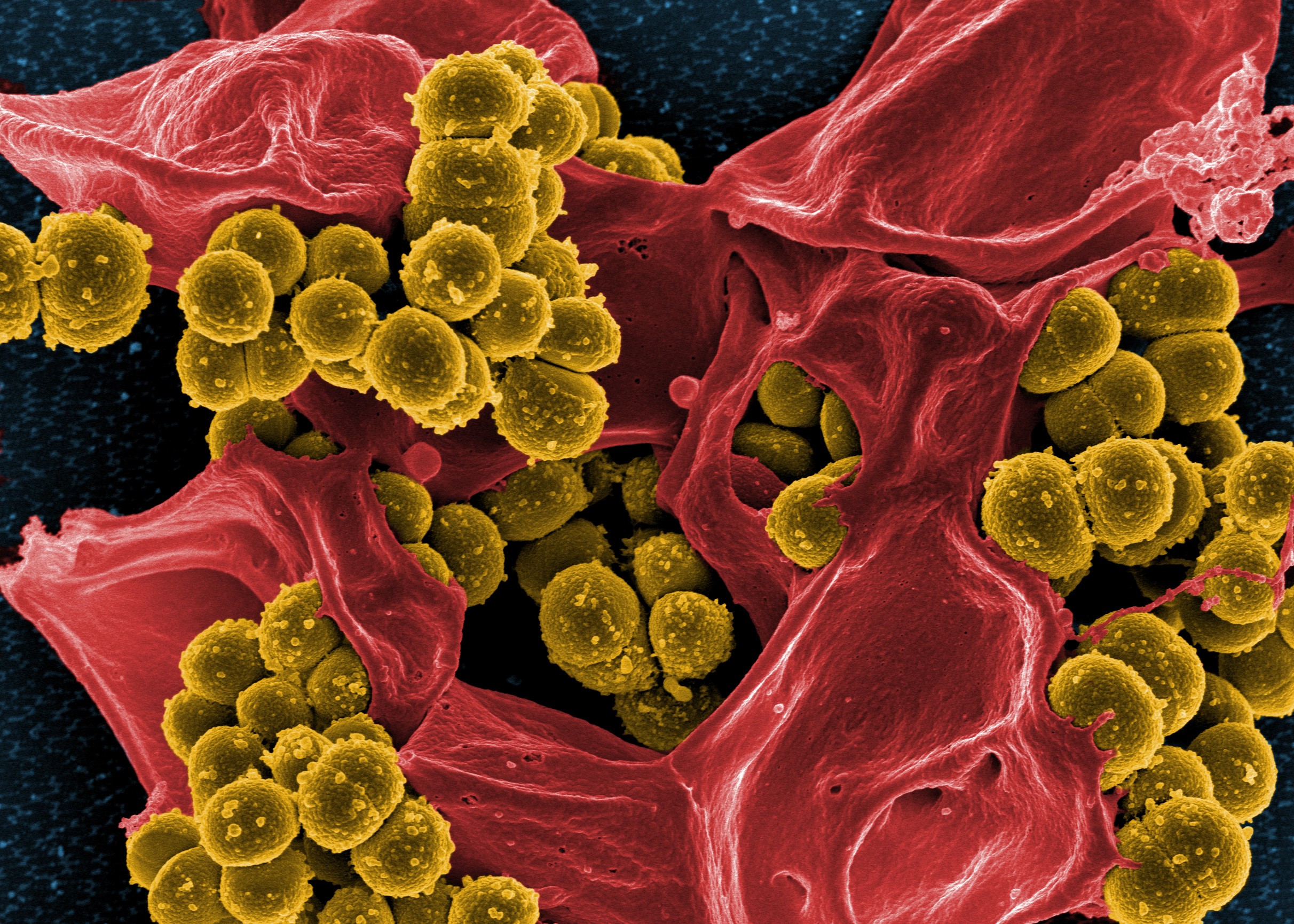 Infecção de estafilococos, bactérias resistentes que sucumbiriam ao Teixobactin (Foto: wikimedia commons)
