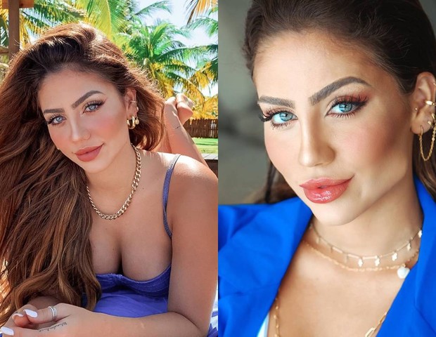 Catherine Bascoy antes e depois de harmonização facial (Foto: Reprodução/Instagram)