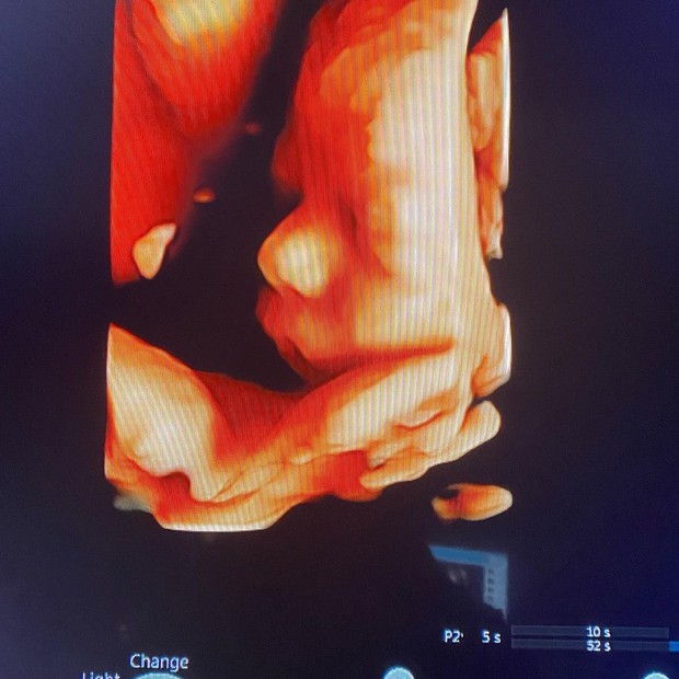 Lucas Lucco mostra ultrassom 3D de Luca (Foto: reprodução/Instagram)