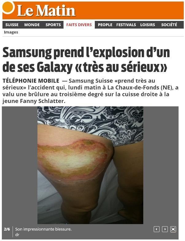 A perna de jovem ficou bastante ferida após a explosão do aparelho. Fanny Schlatter pretende apresentar uma queixa judicial contra a Samsung (Foto: Reprodução Internet/Lematin.ch)