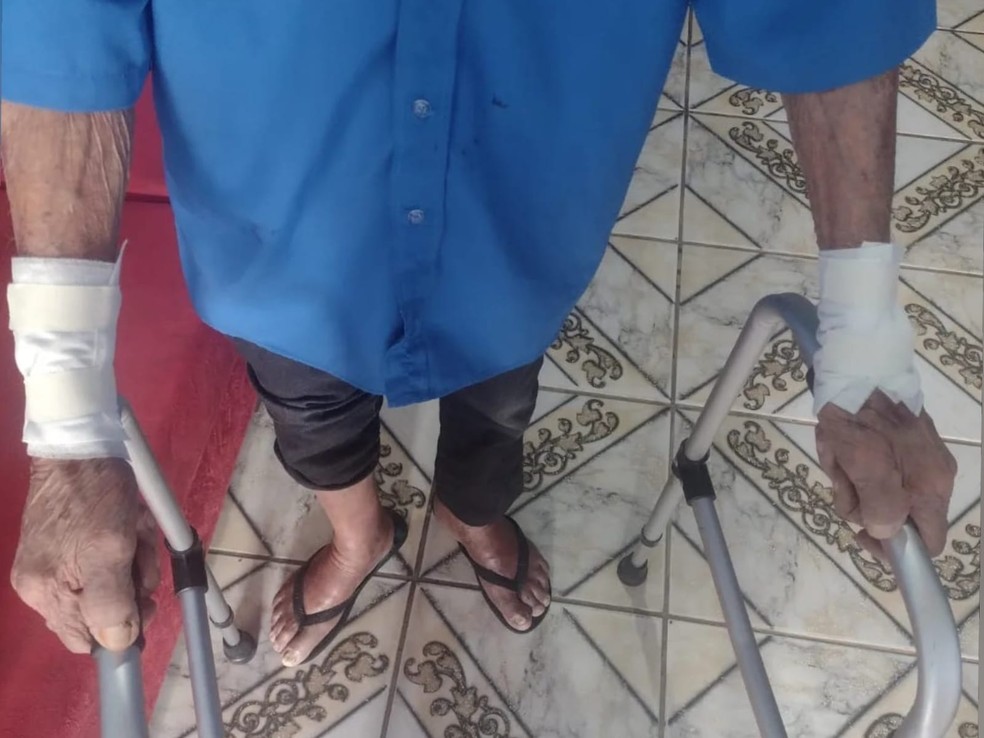 Idoso de 80 anos foi socorrido após ser agredido e ter os braços cortados pelo próprio filho na cidade de Poranga. — Foto: Reprodução
