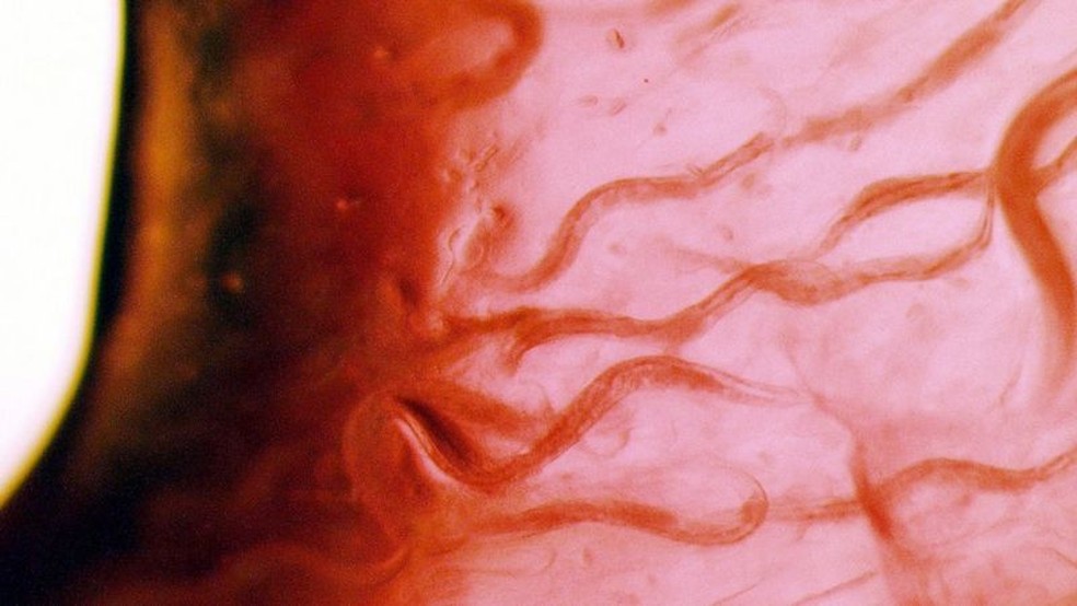 Estes são os C. elegans que estavam a bordo do ônibus espacial e que, apesar de tudo, sobreviveram — Foto: Getty Images via BBC
