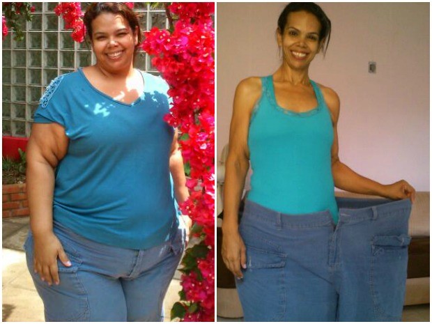 Patrícia Geber, de 41 anos, perdeu 82 quilos. "Perdi metade de mim". (Foto: Arquivo Pessoal/Patrícia Geber)