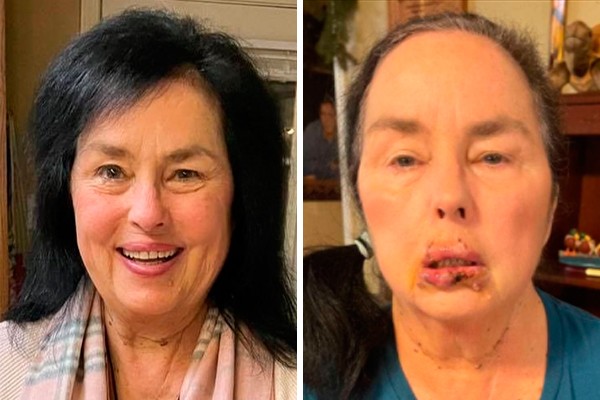 Kay Robertson antes e depois do ataque de seu pet (Foto: reprodução Instagram e Twitter)
