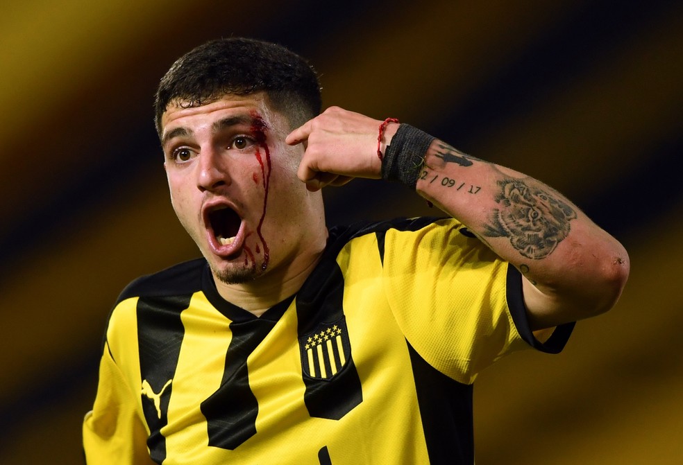Agustin Alvarez Martinez, do Pe&Atilde;&plusmn;arol, mostra o sangramento no rosto ap&Atilde;&sup3;s choque em jogo com Nacional: cl&Atilde;&iexcl;ssico teve tr&Atilde;&ordf;s expuls&Atilde;&micro;es no final &acirc; Foto: Pablo Porciuncula/Reuters