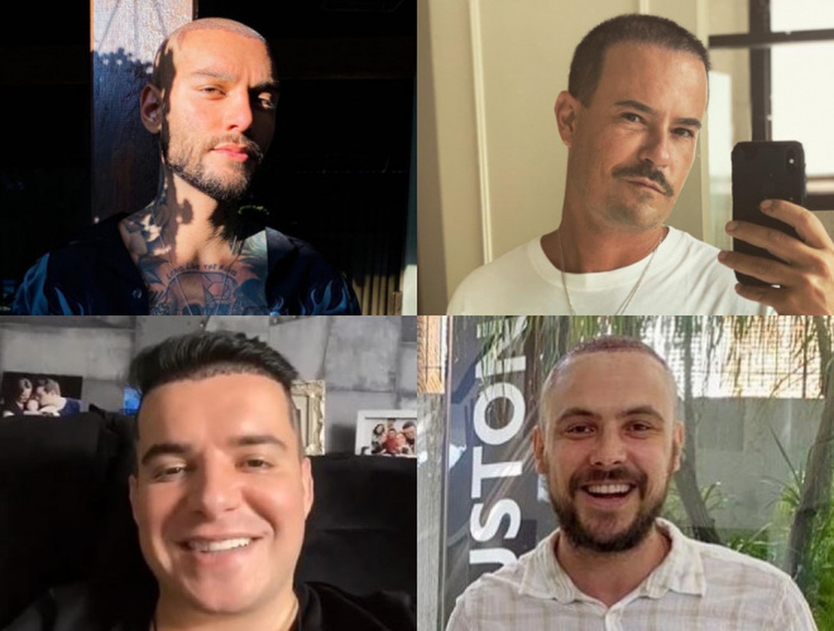 Transplante Capilar Saiba Tudo Sobre O Procedimento Que Esta Em Alta Entre Os Famosos Moda E Beleza Gshow