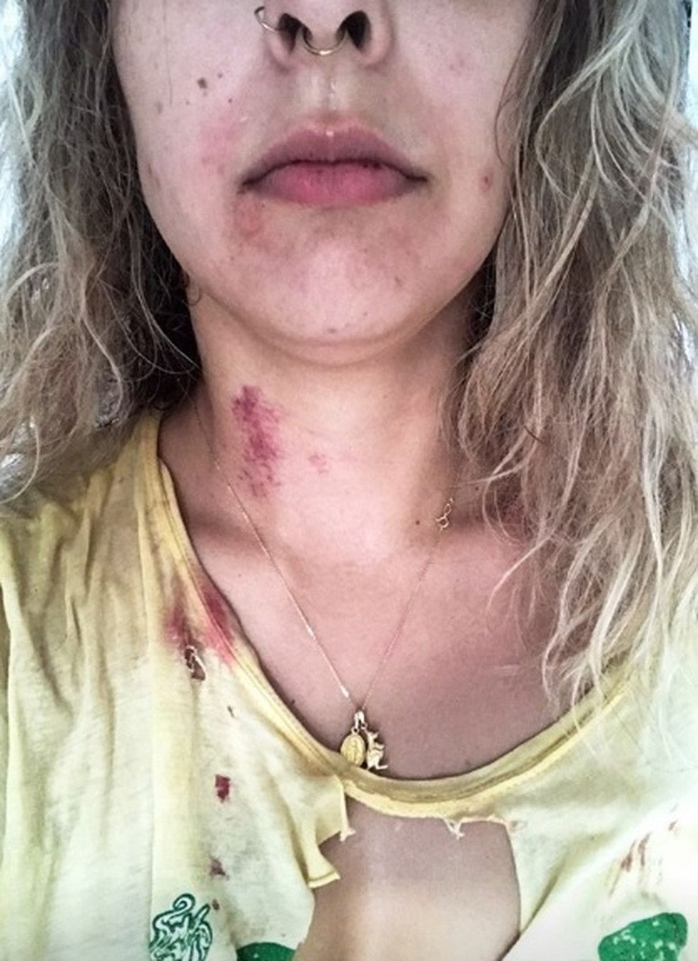 Laura teria sido enforcada pelo ex-namorado — Foto: Instagram/Reprodução