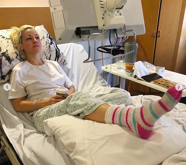 A cantora australiana Kate Miller-Heidke com a perna imobilizada por causa de uma infecção  (Foto: Instagram)