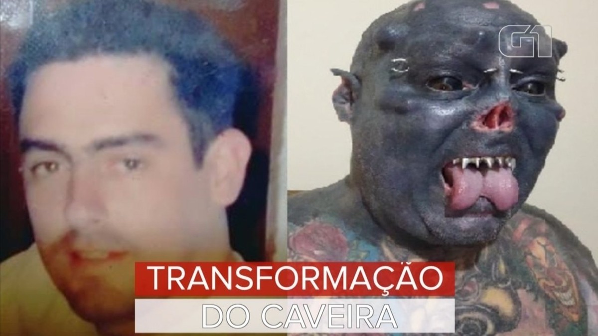 Dentes de vampiro, orelhas de orc e nariz mutilado: tatuador explica transformações para virar o 'Caveira' - Vimarsana News
