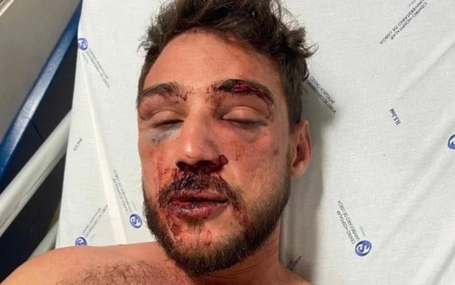 V&iacute;timas n&atilde;o sabem se viol&ecirc;ncia foi motivada por homofobia ou xenofobia