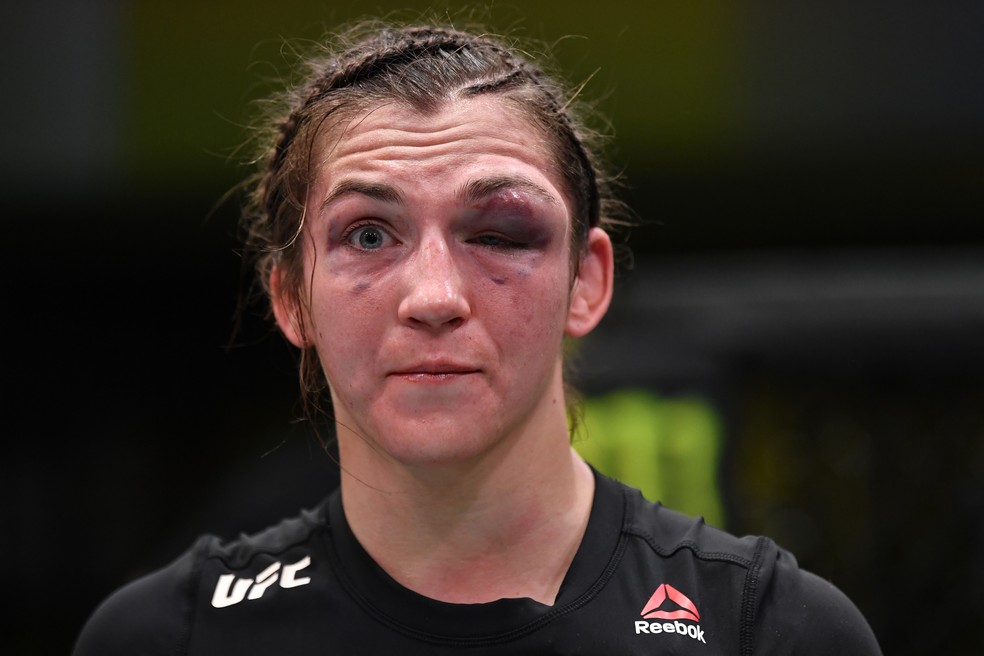 Montana de la Rosa terminou a luta contra Mayra Sheetara com o olho muito machucado — Foto: Getty Images