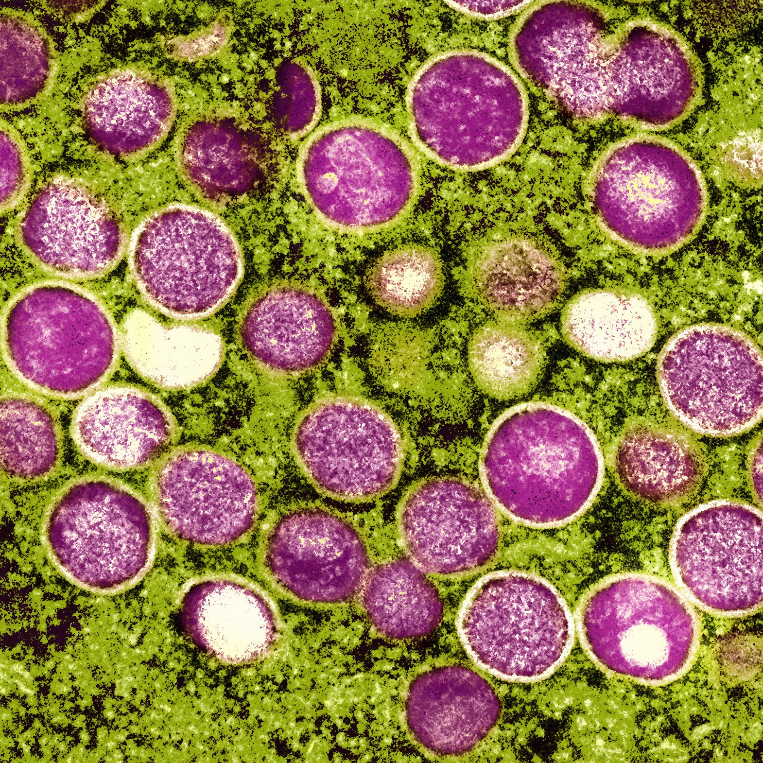Micrografia colorida de partículas de varíola de macaco (rosa) encontradas dentro de uma célula infectada (verde) (Foto: NIAID)