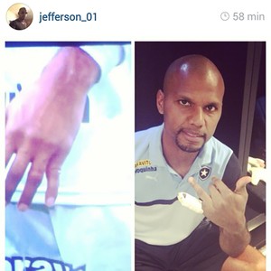 Jefferson Botafogo dedo machucado (Foto: Instagram)