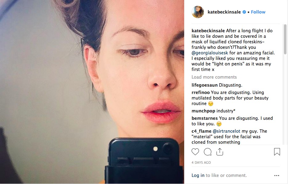 O post no qual a atriz Kate Beckinsale celebrou o uso da técnica com prepúcio de bebês (Foto: Instagram)