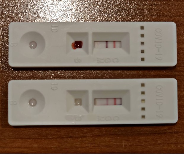 Mãe postou foto de testes de anticorpos feitos com seu sangue e seu leite materno (Foto: Reprodução/Facebook/Salud Materno-Infantil Sevilla)