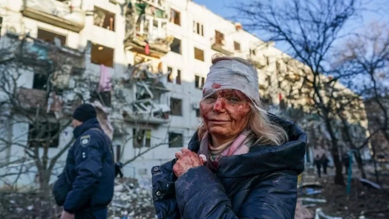 Mulher fica ferida em explosão de edifício durante ofensiva militar russa em Chuguiv, no leste da Ucrânia, na manhã de 24/2 (Foto: Wolfgang Schwan/Anadolu Agency via Getty Images)