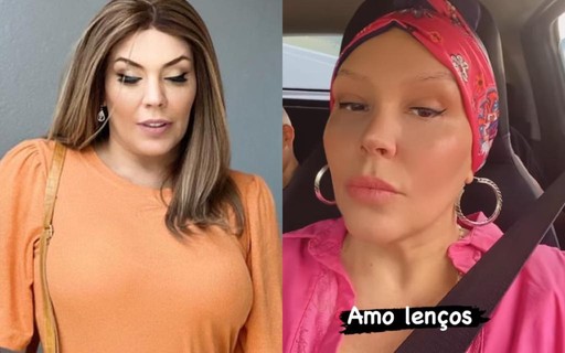 Tratando câncer, Simony lamenta queda de cabelo: "Muito triste para uma mulher"