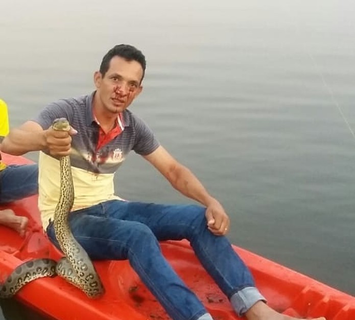 Empresário estava pescando quando foi atacado pela cobra — Foto: Arquivo Pessoal
