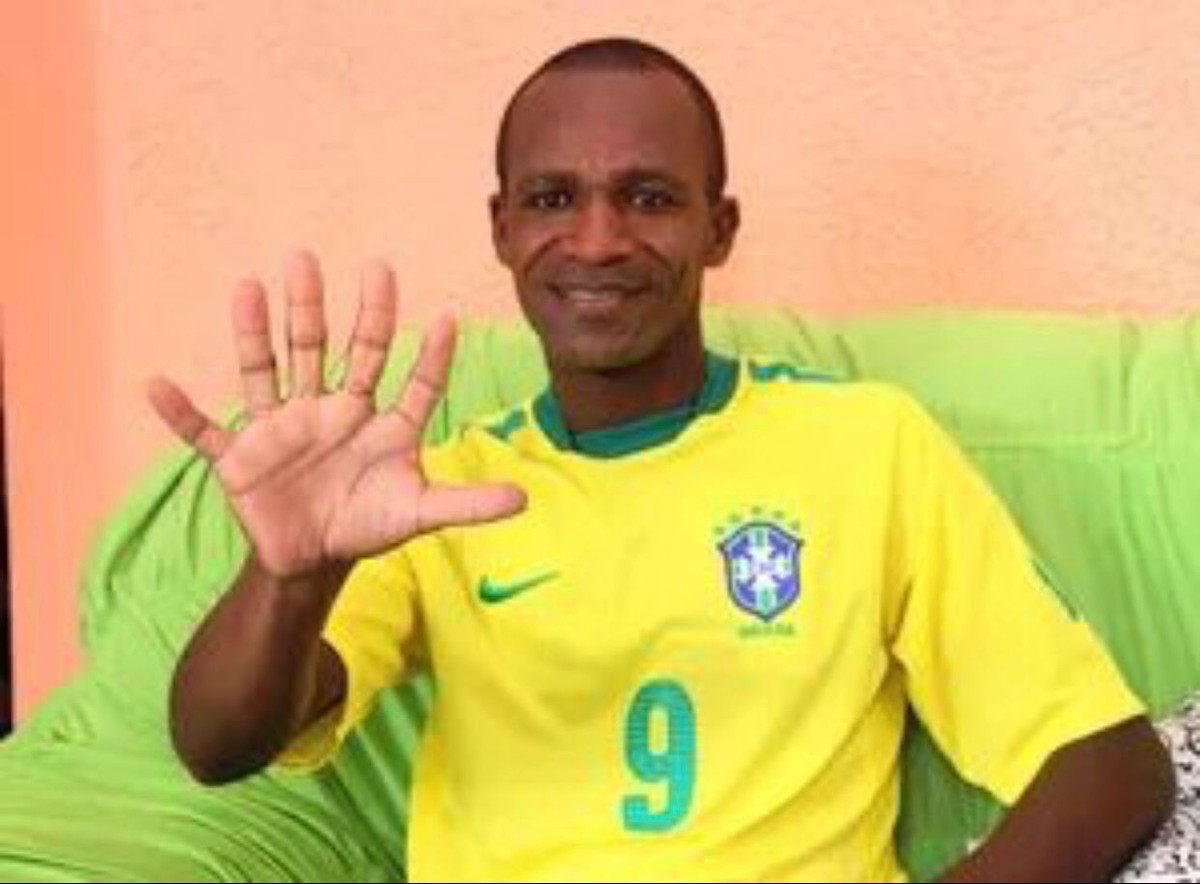 Baiano com seis dedos pretende comemorar hexa da seleção com ...