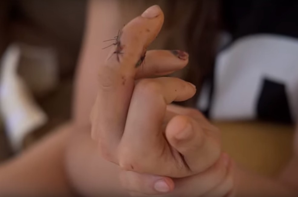 Ronda Rousey mostra o dedo costurado — Foto: Reprodução/Youtube