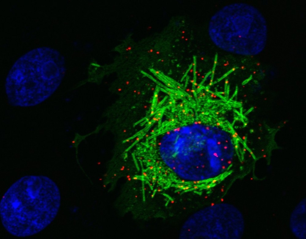 Ensaio em cultura de células mostra a interação da proteína celular PCNA e a proteína M do Sars-CoV-2. Em vermelho, proteína humana PCNA migra do núcleo da célula (em azul) para o citoplasma na presença da proteína M (verde). (Foto: Orlando B. Scudero/ICB-USP)